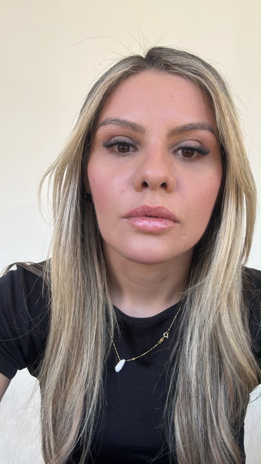 Antes do resultado facial - paciente 1